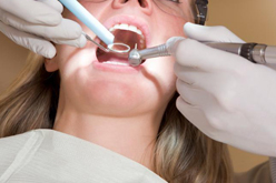 Femme chez le dentiste pour un détartrage